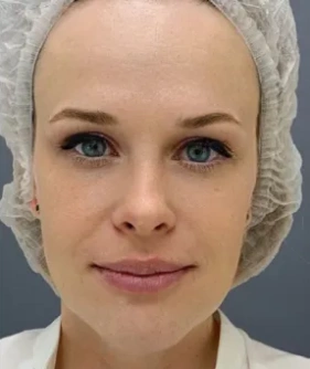 WOW-effect procedure