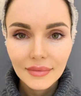 WOW-effect procedure