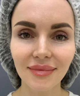 WOW-effect procedure