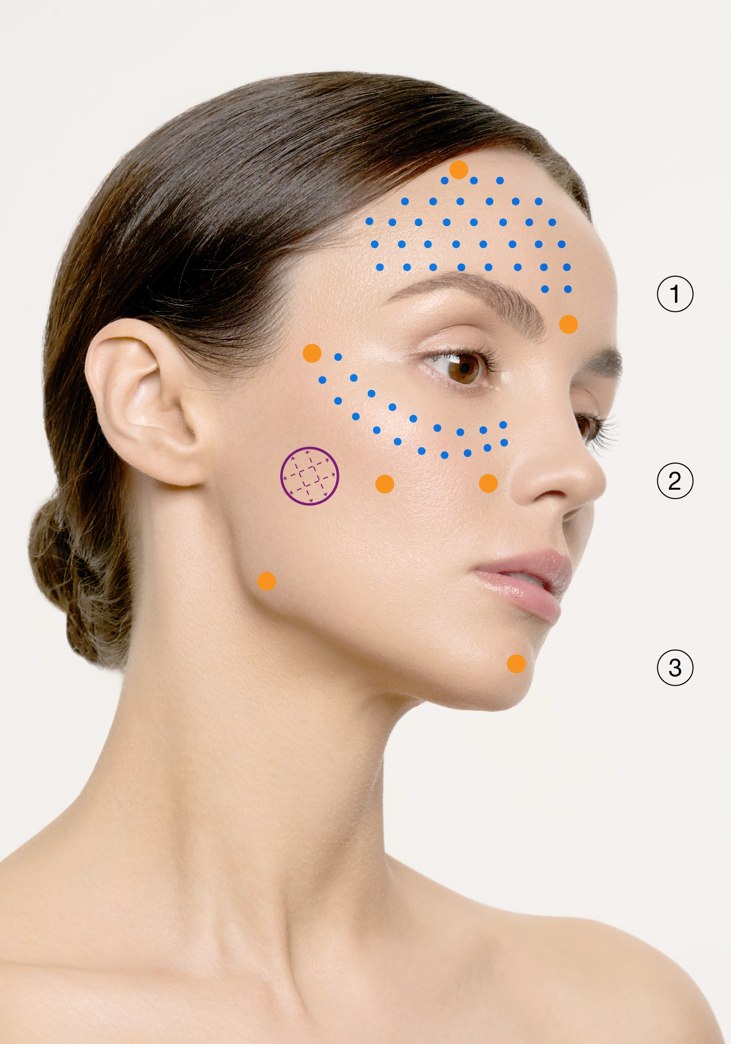 Post-Acne