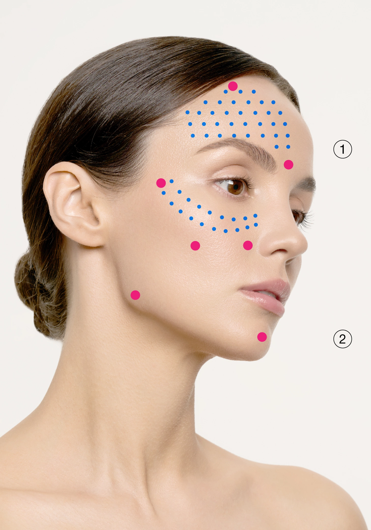 Post-Acne