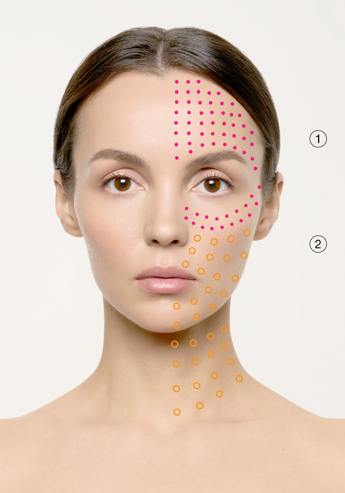 Pigmentation, Rosacea
