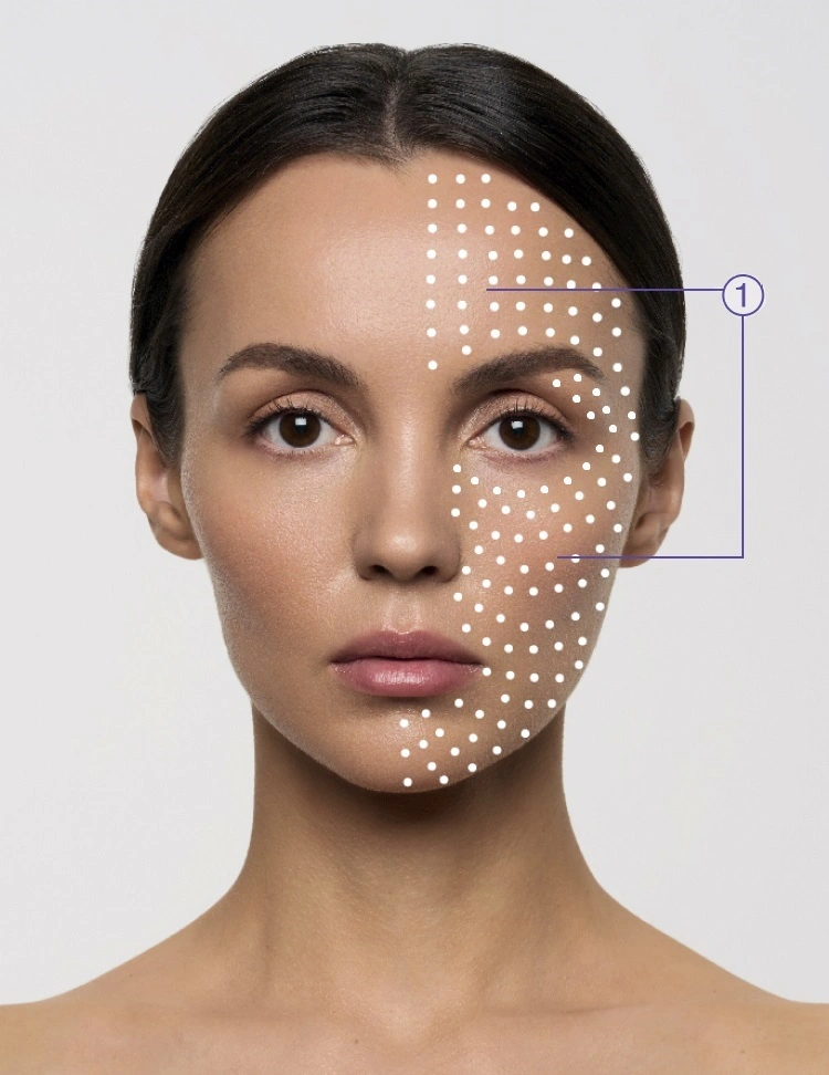 Micropapular Technique